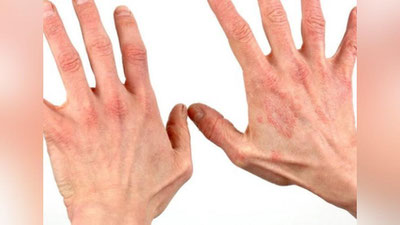 'Shifo maslahat: “QIChIMA – QARILIK ALOMATIMI?”'ning rasmi