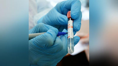 'Олимлар COVID-19 вакцинасини организм ҳужайраларига етказишнинг янги усулини ўрганишмоқда'ning rasmi