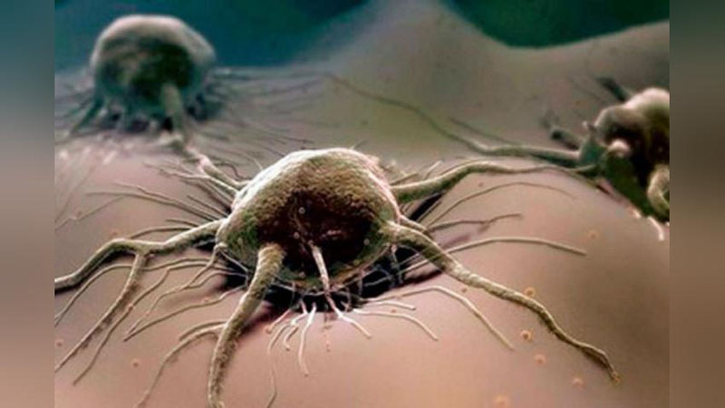 'O`zbekistonda saratonni erta aniqlash amaliyoti yo`lga qo`yiladi'ning rasmi