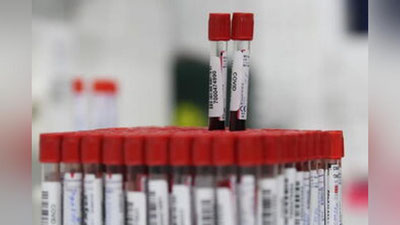 'Bugun O`zbekistonda koronavirus bilan kasallanganlar soni rekord ko`rsatkichni qayd etdi. Ahvoli o`ta og`irlashgan bemorlar soni ham ortdi'ning rasmi