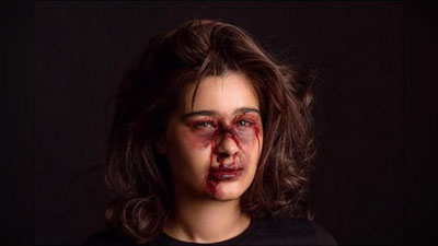 '​18 ta mashhur ayollarning "kaltaklanishi"ga nima sabab bo`ldi? (foto)'ning rasmi