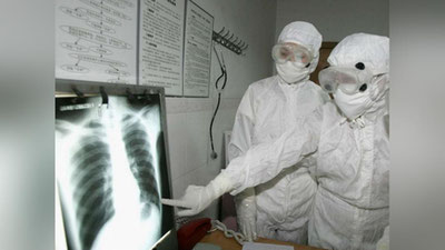 'Olimlar koronavirusning uzoq muddatli yangi asoratlaridan ogohlantirdi'ning rasmi