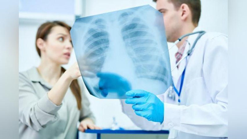 'Pnevmoniyadan vafot etganlar soni 214 nafarga etdi'ning rasmi