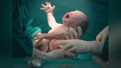 'Ona miyasi o`lgandan keyin  chaqaloq dunyoga keldi'ning rasmi