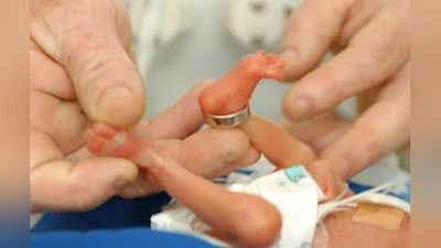 'Toshkentda homiladorlikning 25-haftasida 480 gramm vaznda tug`ilgan chaqaloq 2 yoshga to`ldi'ning rasmi