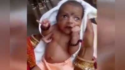 'Hindistonliklar uch qo`l bilan tug`ilgan chaqaloqqa topina boshlashdi 'ning rasmi