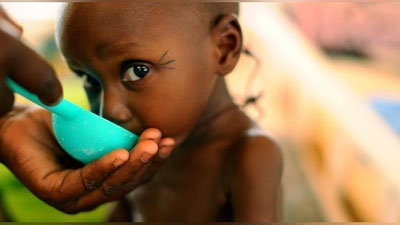 '​YuNISEF 1,4 million bola ocharchilikdan halok bo`lishga mahkumligini ma`lum qildi 'ning rasmi