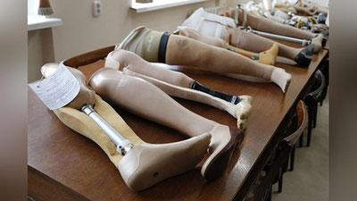 'Protez-ortopediya buyumlarini ishlab chiqaruvchilar bojxona to`lovidan ozod etildi'ning rasmi