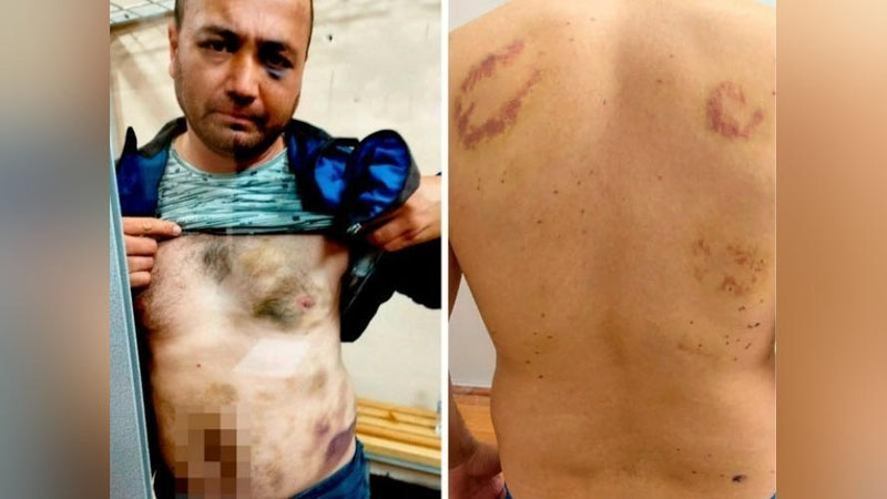 'Ombudsman ikki fuqaroning tergov binosida kaltaklanganiga munosabat bildirdi'ning rasmi