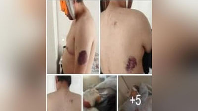 'Chortoqlik fuqaroni bir necha notanish shaxslar do`pposlagani haqida rasmiy ma`lumot berildi'ning rasmi