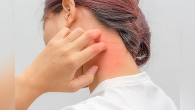 'Зардоб касаллигидан асосан аллергияга мойил кишилар азият чекади'ning rasmi