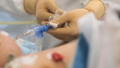 'Dunyoda har ikki soniyada bir kishi yuqumli bo`lmagan kasalliklardan vafot etmoqda - JSST'ning rasmi