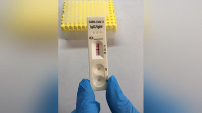 Изрображение 'Центр «Стратегия развития» передал СЭС от зарубежных партнеров экспресс-тесты на COVID'