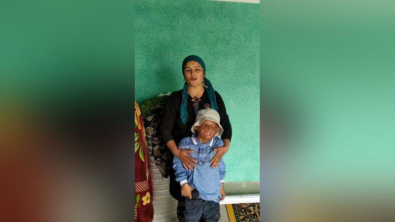 'Samarqandlik kuygan bolaning hikoyasi kutilmagan tus oldi'ning rasmi