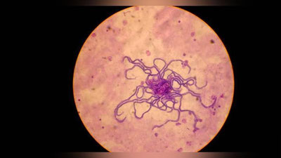 'Rassom ko`zidagi “chuvalchanglar” tufayli mashhur bo`ldi'ning rasmi