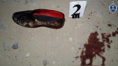 'Shahrisabzda 21 yoshli yigit 170 ming so`m qarzini bermagani uchun tanishini pichoqlab o`ldirdi'ning rasmi