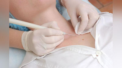 'Madad-shifo: “QIZIL NEVUS NIMA DEGANI?”'ning rasmi