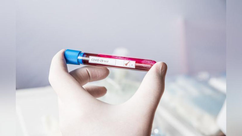 'Олимлар SARS-CoV-2 вирусининг кенг спектри ва унга яқин бўлган коронавируслар билан кураша оладиган антитаначани аниқлашди'ning rasmi