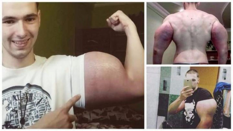 'BILAKLARINI KATTALAShTIRISh UChUN QO`L TERISI OSTIGA OLTI LITR SINTOL YuBORGAN YIGIT'ning rasmi