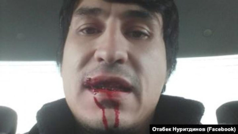 'Bloger Otabek Nuritdinov nega kaltaklandi? (video)'ning rasmi