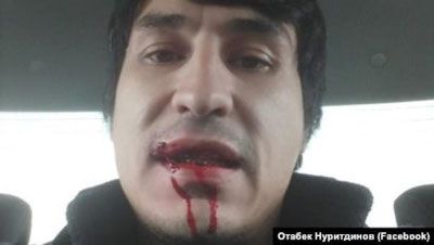 'Bloger Otabek Nuritdinov nega kaltaklandi? (video)'ning rasmi