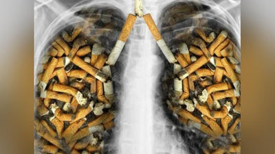 'Sigaret tutuni har to`rt soniyada bir kishining hayotiga nuqta qo`ymoqda'ning rasmi