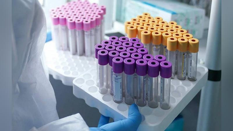 'Rossiyada koronavirusga qarshi ikkinchi vaksinani ishlab chiqarish boshlandi'ning rasmi