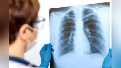 'Kecha 140 nafar kishida pnevmoniya aniqlandi'ning rasmi