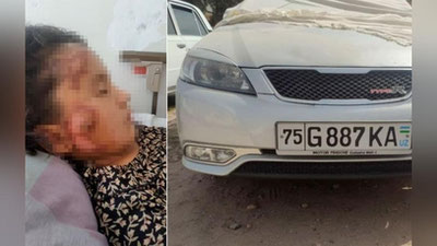 'Sho`rchida Lacetti 8 yashar qizni urib yubordi'ning rasmi