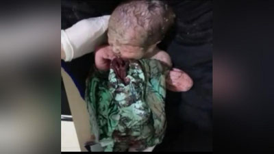 'Қорақалпоғистонда янги туғилган чақалоқ кўчага ташлаб кетилди'ning rasmi