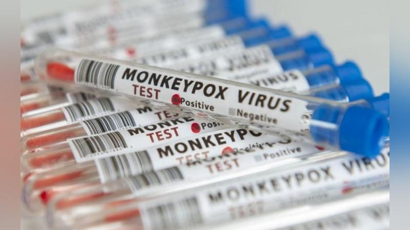 'JSST: Dunyoda mpox virusini yuqtirganlar soni 84 mingdan oshdi'ning rasmi