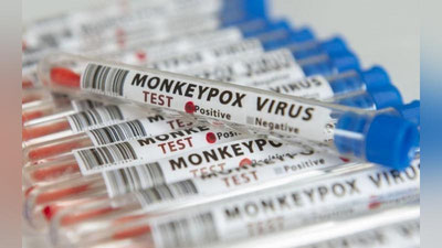 'JSST: Dunyoda mpox virusini yuqtirganlar soni 84 mingdan oshdi'ning rasmi