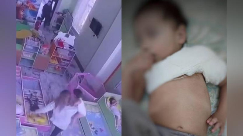 'Toshkentdagi bog`chada bolaga tan jarohati etkazgan enaga yordamchisiga jinoyat ishi ochildi'ning rasmi
