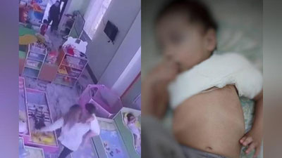 'Toshkentdagi bog`chada bolaga tan jarohati etkazgan enaga yordamchisiga jinoyat ishi ochildi'ning rasmi