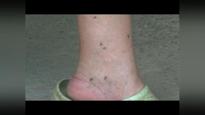 'Xorvatiyaning sharqiy qismida odamlar chivinlar hujumidan aziyat chekishmoqda (Video)'ning rasmi