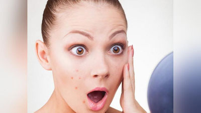 'Shifo maslahat: “YuZIMGA TOShMA TOShDI...”'ning rasmi