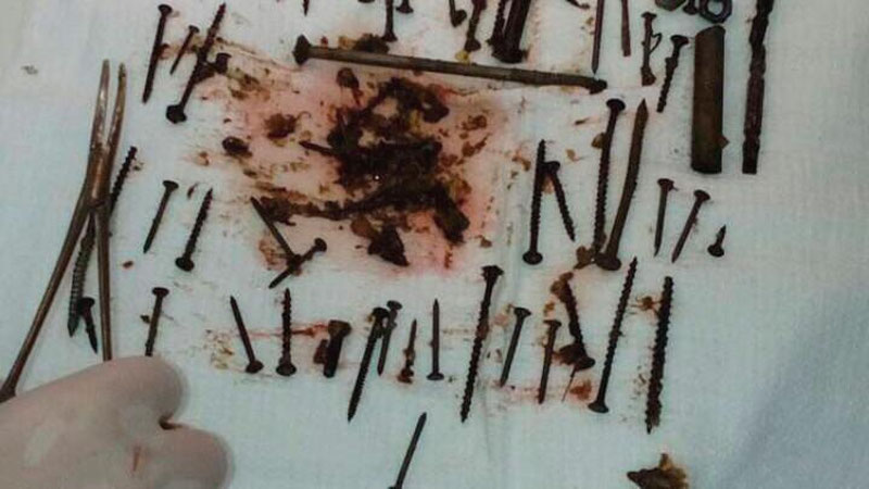 'БУРЯТИЯЛИК ПЕНСИОНЕР АЁЛНИНГ ОШҚОЗОНИДАН ЎНЛАБ МИХЛАР, БОЛТЛАР ВА КУМУШ ЗАНЖИР ТОПИЛДИ'ning rasmi