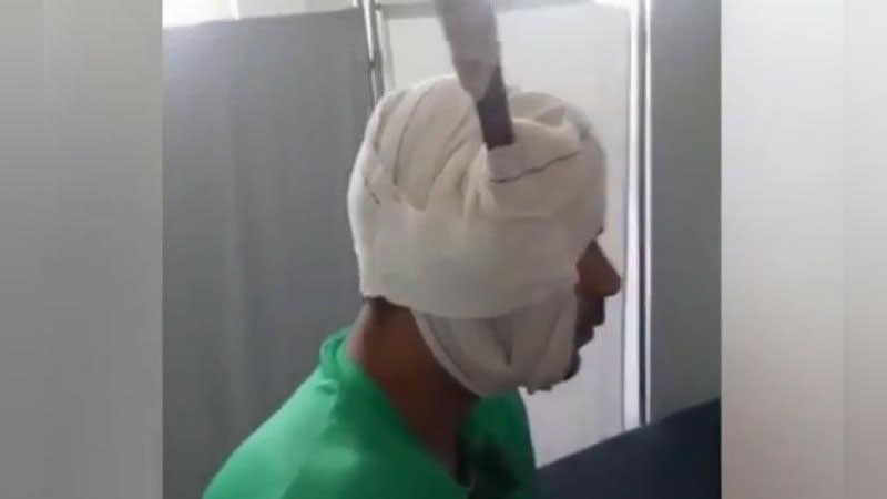 Изрображение 'В БРАЗИЛИИ ПРЕСТУПНИК ХОДИЛ ПО УЛИЦЕ С МАЧЕТЕ В ГОЛОВЕ (ВИДЕО, 18+)'