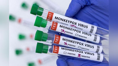 'Москва Ўзбекистонга маймунчечакни аниқлайдиган тестлар берди'ning rasmi