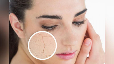 'Қуруқ юз териси – муаммо эмас 'ning rasmi