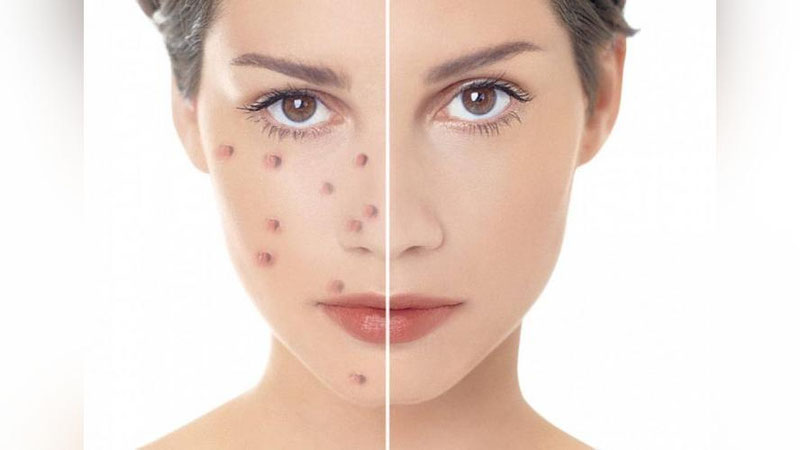 '“YuZDAGI DOG`LAR JIGAR KASALLIKLARIDAN DARAKMI?”'ning rasmi