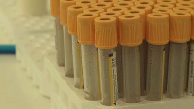 'Gresiyada odamlar cho`chqa grippidan halok bo`lmoqda'ning rasmi