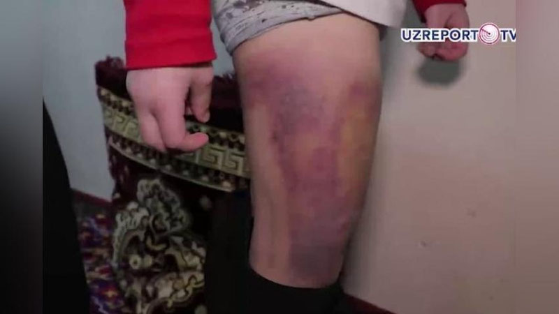 'Тошкентда “хужра”да болаларга ноқонуний диний таълим бериб, уларни калтаклаган шахс қўлга олинди (видео)'ning rasmi