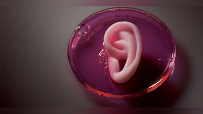 'Amerikalik qizning bilagida yangi quloq o`sib chiqdi'ning rasmi