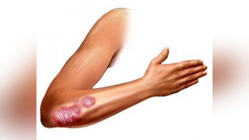 'JAROHATDAN SO`NG TIRSAKDA QON YIG`ILSA...'ning rasmi