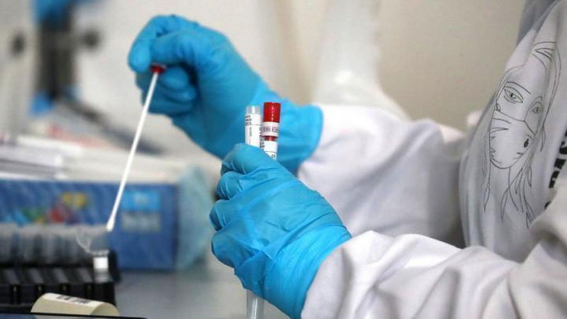 'Kecha O`zbekistonda 392 nafar kishida koronavirus aniqlandi'ning rasmi
