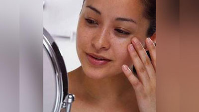 '​Юздаги доғ ва сепкиллардан қутулиш чоралари'ning rasmi