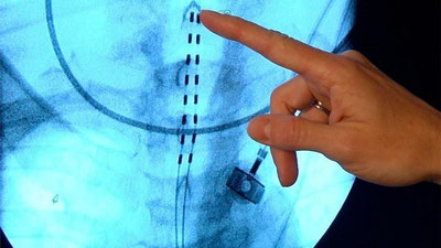 'Shifo maslahat: “QIZIMDA KISTA BOR EKAN...”'ning rasmi