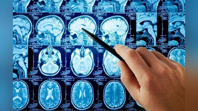 'Ўзбекистонда тутқаноқ касаллигини замонавий усулда даволаш йўлга қўйилди'ning rasmi