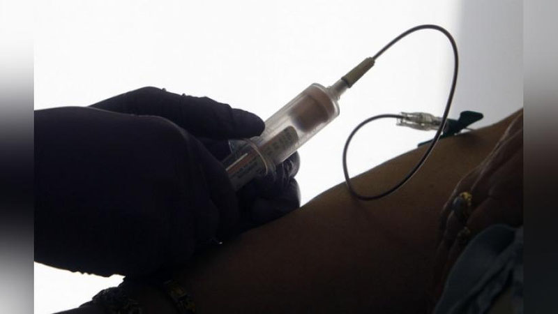 'Саратонни эрта аниқловчи янги тахшис-тест яратилди'ning rasmi